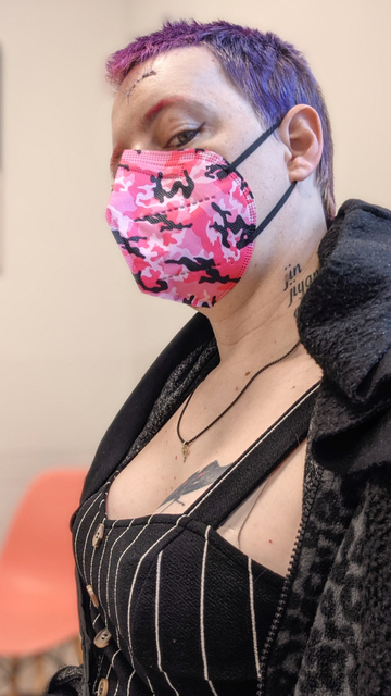 Me with 7 stitches on my head from when a nazi hit my head with a metal bat in 2023.  I was unarmed and still won.

I'm wearing a pink FFP2 mask in a camo pattern, purple-pink very short hair, and a black pinstripe top with a low enough cut to show the butterfly tattoo on my breast.