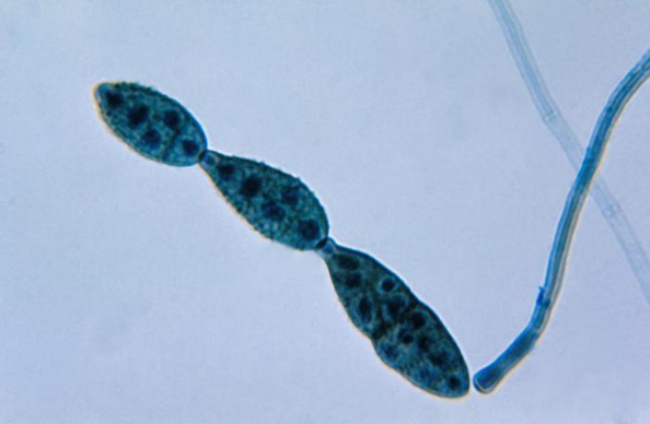 Image of Alternaria, the taxon in which the compound is found.